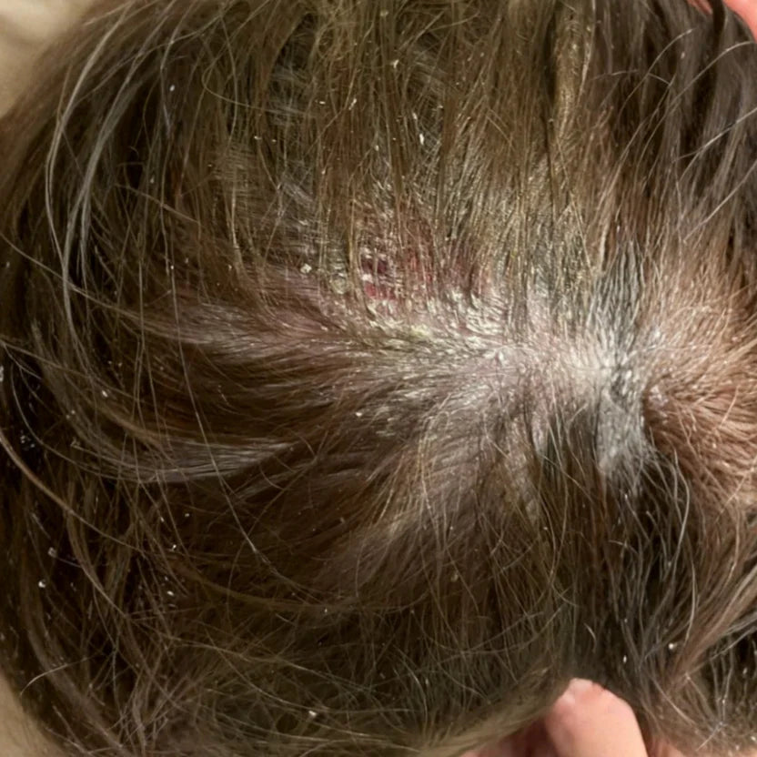 image comparison before