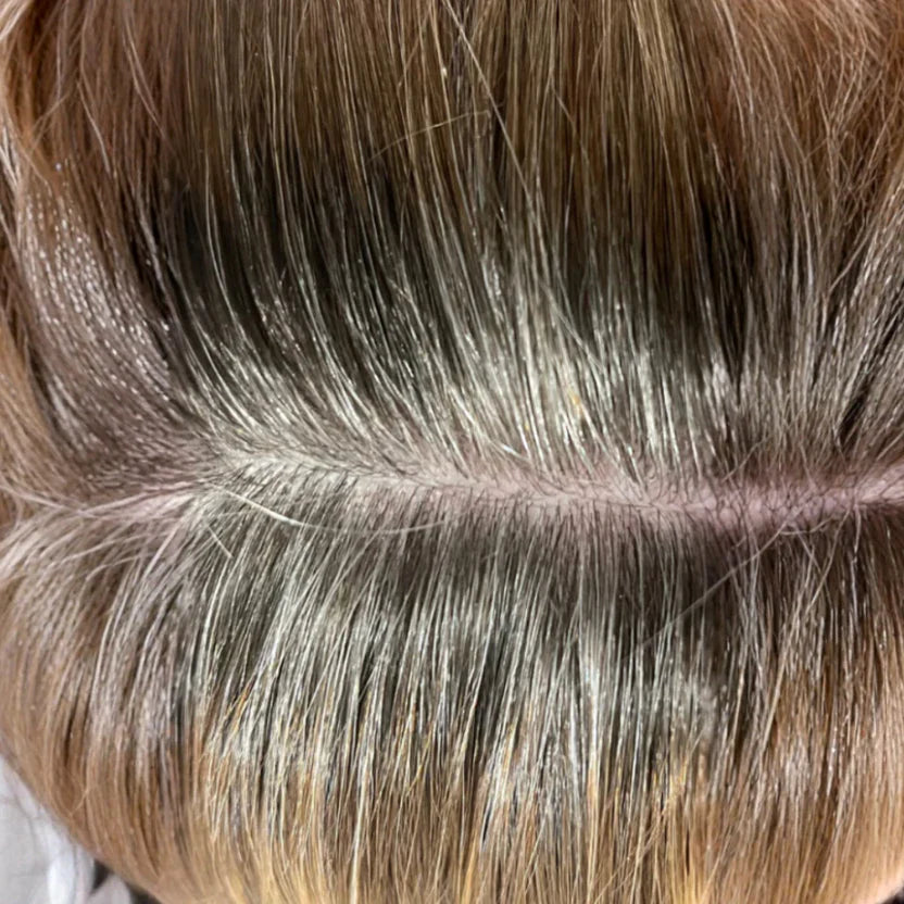 image comparison after